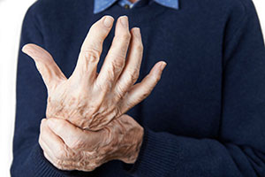 Photo of lady with Arthritis Hand Pain
