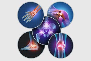 Graphic of varied areas of joint pain