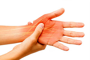 Graphic of Hand Showing Nerve Pain