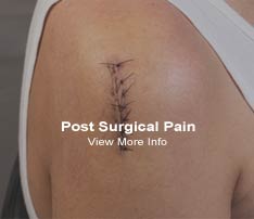Graphic of Person Having Post Surgical Pain