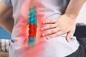 Graphic of painful back vertebrae