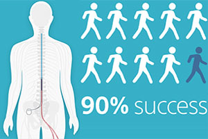 Graphic of spinal cord stimulator success